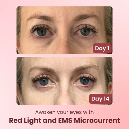 Red Light Eye Massager